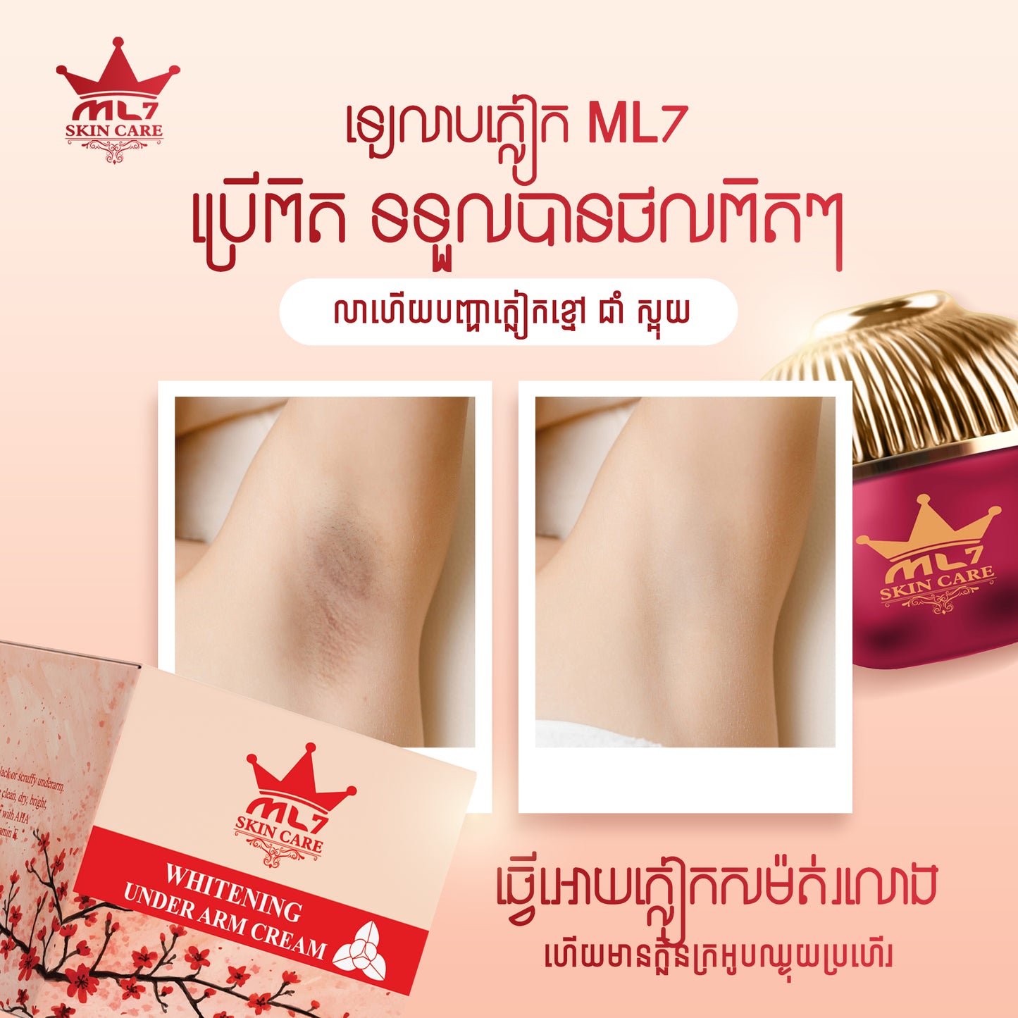 Skin Lightening Underarm Cream