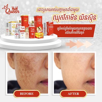 MM Queen Skincare Sets