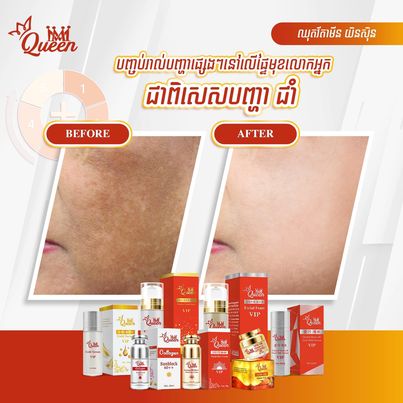 MM Queen Skincare Sets