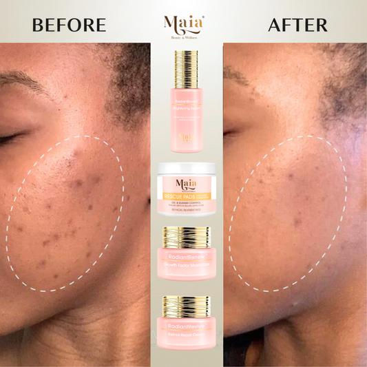 Maia Skin Brightening Set | Dark Spots Corrective