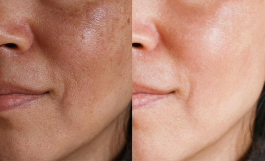 Clavier Anti-Pigmentation Cream