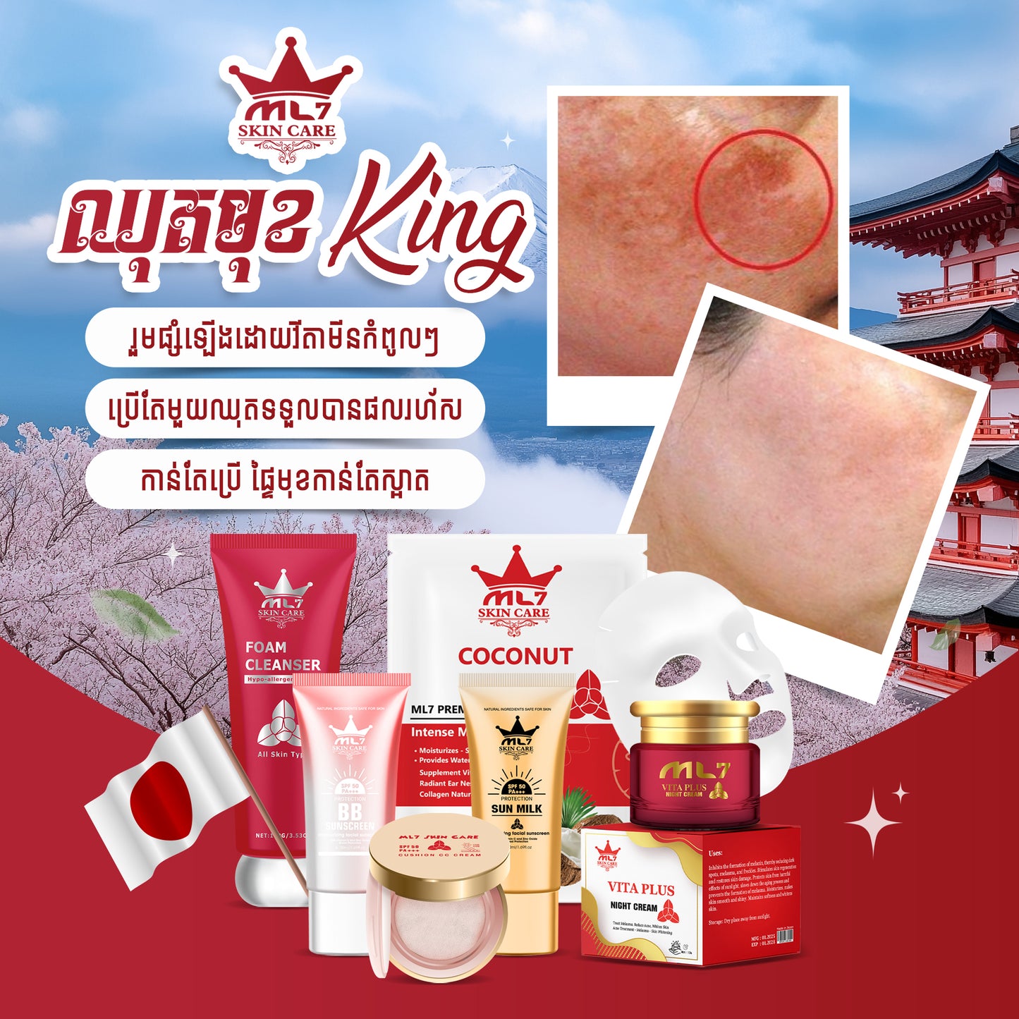 King Melasma Skincare Set