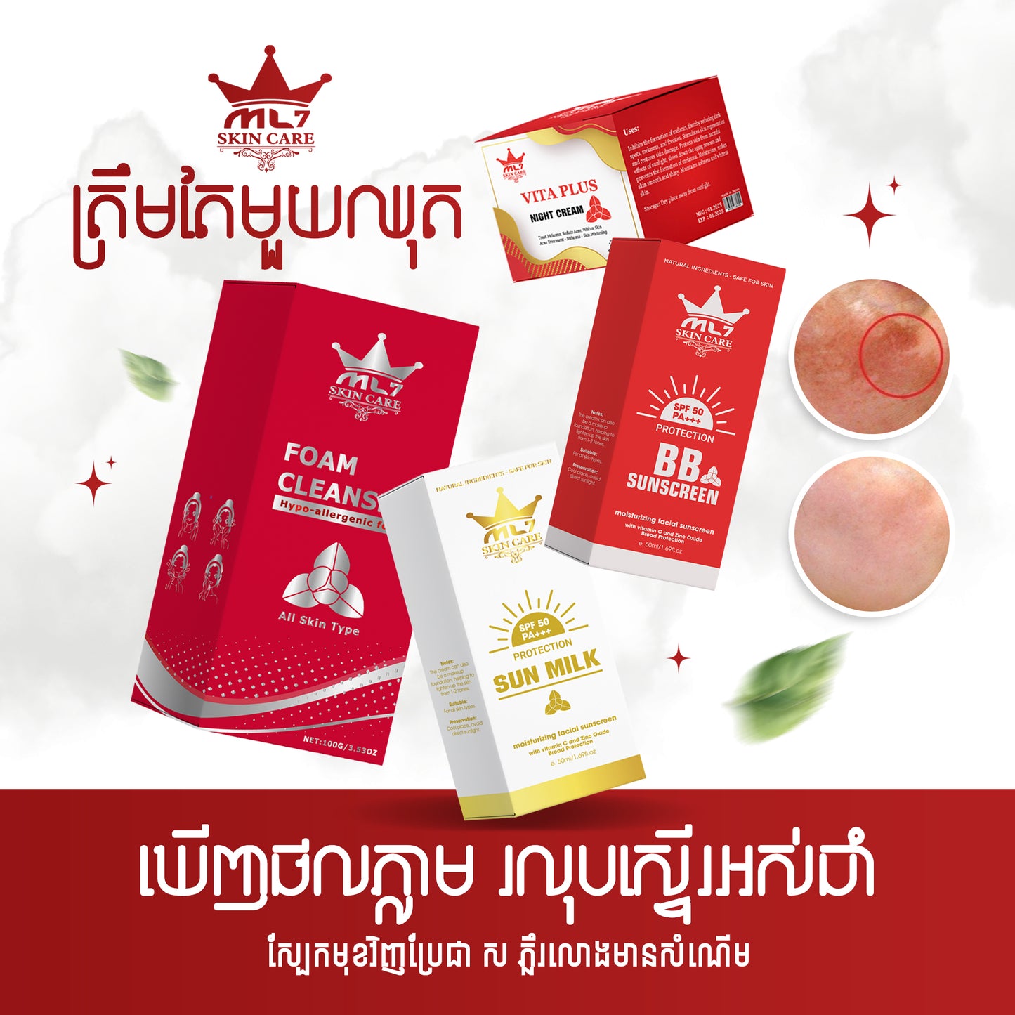 King Melasma Skincare Set