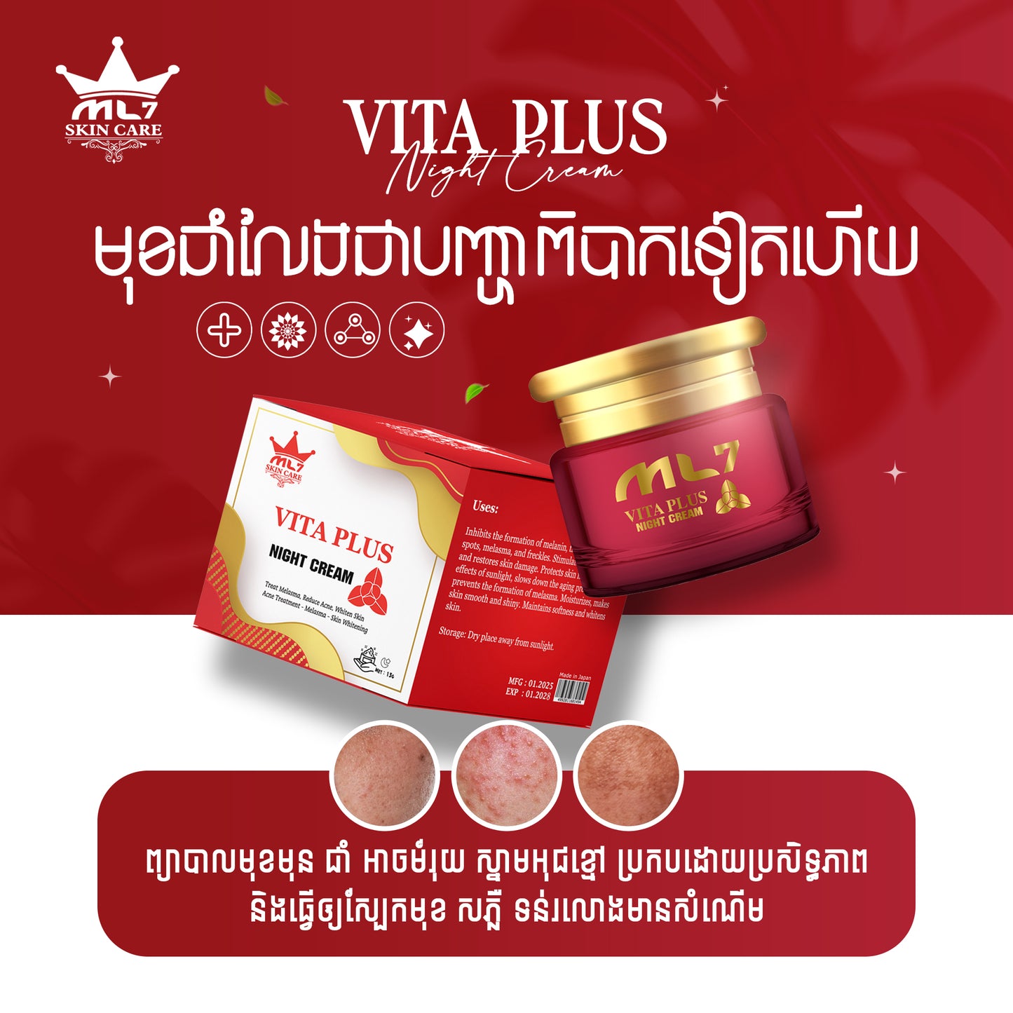 Vita Plus Night Cream | Melasma, Hyperpigmentation