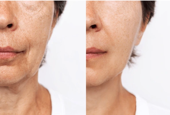 [SALE]Twin Magic Serum Collagen