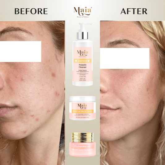 Maia Oil & Blemish Control Set | Skin Balancing. Anti-Acne